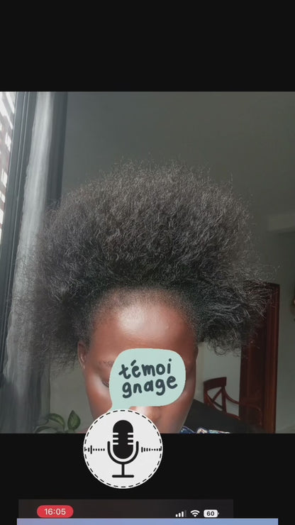 Stop alopécie